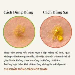 Opla kem chấm mờ thâm sau mụn
